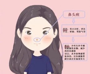 痘痘一般有哪些类型