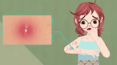 成人痘与青春痘症状
